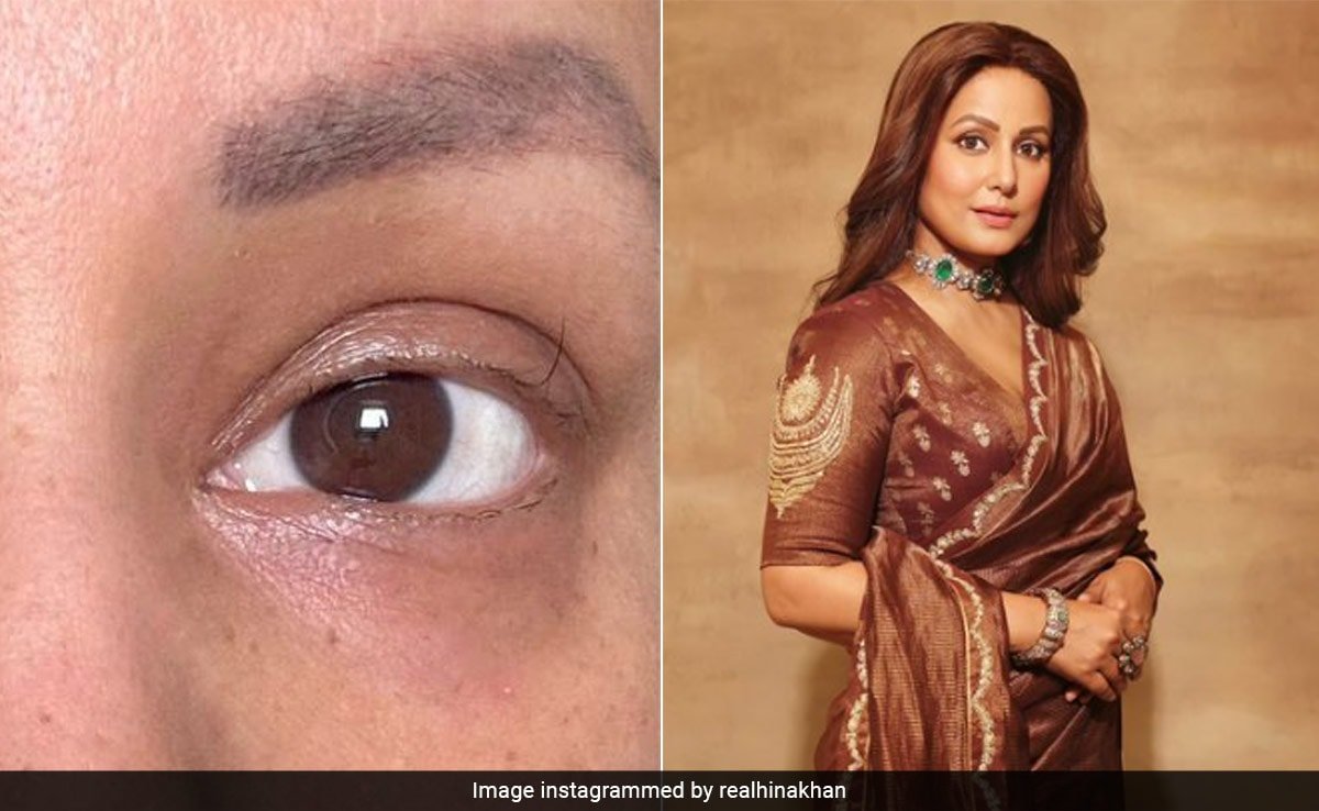 Hina Khan Shares Pics Of Her "Last Standing Eyelash" Amid Cancer Battle: "Haven